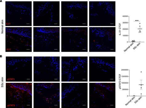 Th2 cell activation in SSc patient skin. Representative images of IL-31... | Download Scientific ...