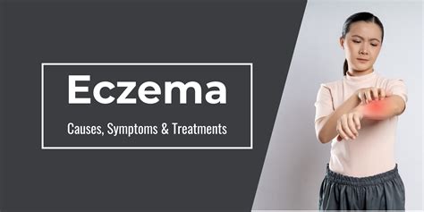 Eczema Treatment: What You Need To Know