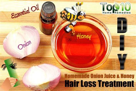 DIY Homemade Onion Juice and Honey Hair Loss Treatment | Top 10 Home ...