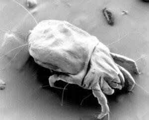 House Dust Mite: Life Cycle, Health Risks | ETS