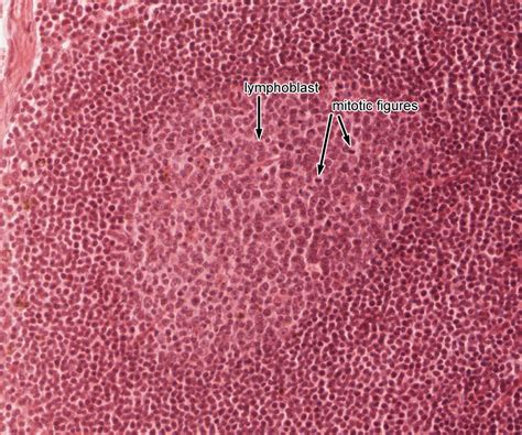 Lymphatic System | histology