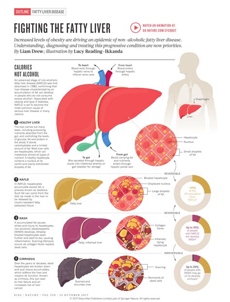 Understanding Fatty Liver Disease and Its Treatment Protocol - Infographic