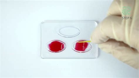 Blood Group Genetics - YouTube