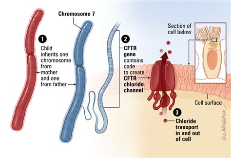 CFTR - Johns Hopkins Cystic Fibrosis Center