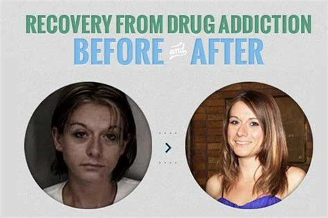 Before and after: Photos of drug addiction recovery