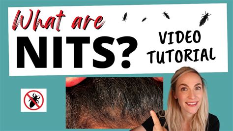 What are Nits? Video! - YouTube