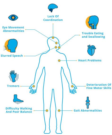 ¿Qué es la ataxia? - National Ataxia Foundation