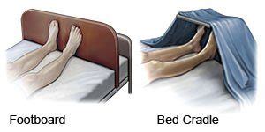 What is a Bed Cradle - Know How Community