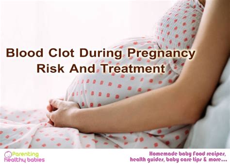 Blood Clot During Pregnancy: Signs, Causes, Treatment, Prevention