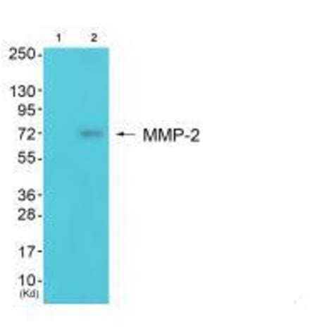 Anti-MMP-2 Antibody (A42712) | Antibodies.com