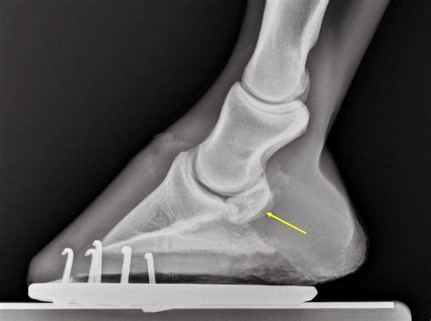 Severe Navicular Disease in a Horse