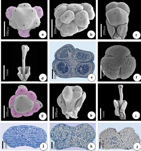 Development of stamens and staminodes in Sinomenium acutum.a–f Stamen... | Download Scientific ...