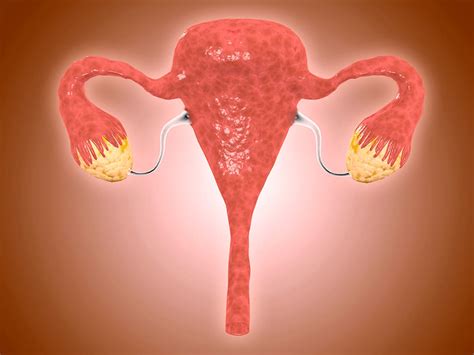 PCOS: what are the symptoms of Polycystic Ovary Syndrome and how is it ...