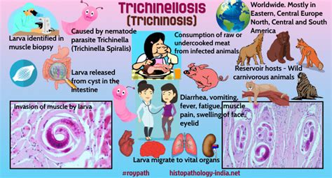 Trichinellosis – symptoms, treatment and causes of the disease ...