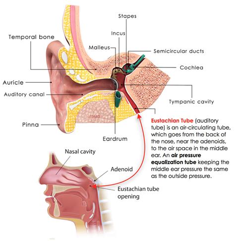 Middle Ear Infection (Chronic Otitis Media) in Children