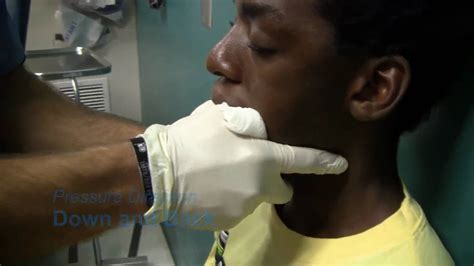 Pediatric Jaw Dislocation Reduction - YouTube