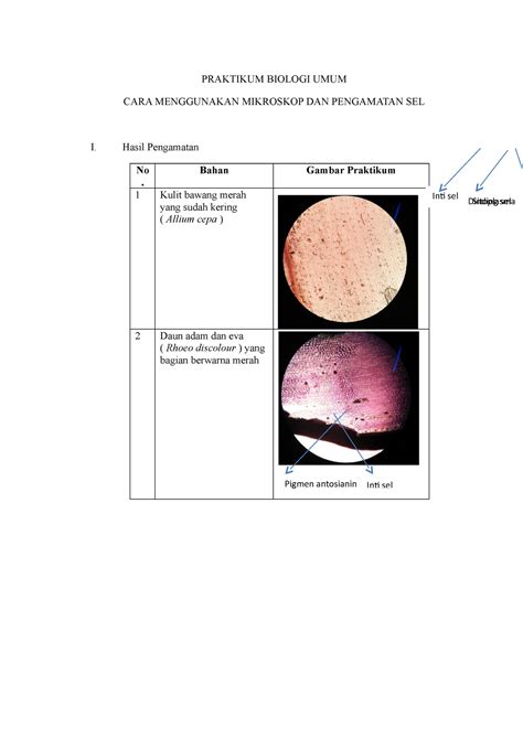 Laporan Praktikum Cara Menggunakan Mikroskop Dan Pengamatan Sel Hot ...