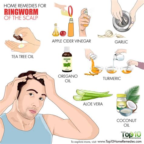 How to Cure Scalp Ringworm | imap.pk | Pakistan Business Directory