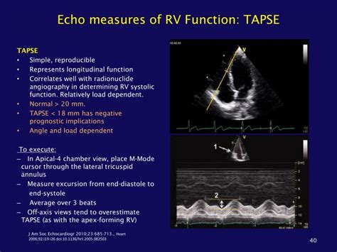 Tapse Echo