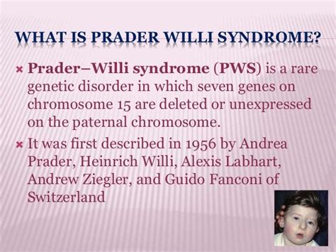 Prader Willi Syndrome Diet - Quotes Home