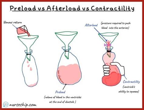 Cardiac Preload vs Afterload vs Contractility |With an example ...