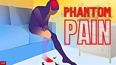 PHANTOM PAIN AND TREATMENT - YouTube