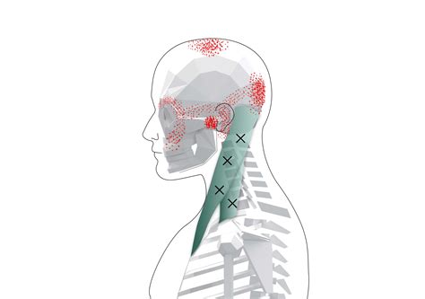 Suboccipitals Trigger Points (Overview and Tips for Self Treatment)