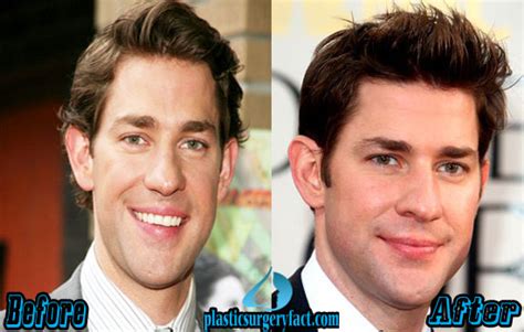 John-Krasinski-Nose-Job-Before-and-After | Plastic Surgery Magazine