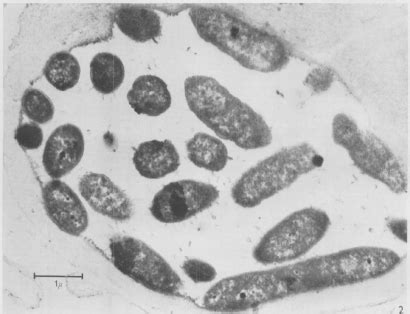 Rickettsia Prowazekii Under A Microscope