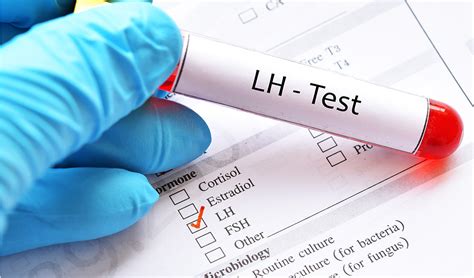 All About LH (Luteinizing Hormone) and LH Test | Bahçeci Blog