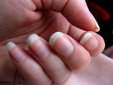 What’s Up With That: Your Fingernails Grow Way Faster Than Your ...