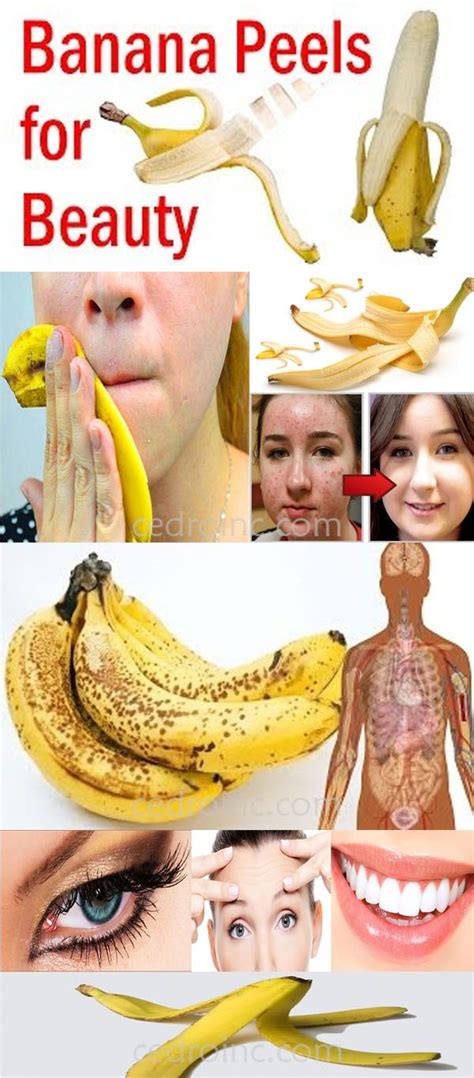 10 Amazing Benefits And Uses Of Banana Peels | Hautpflege, Haut, Beauty