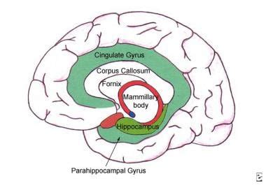 Imaging in Mesial Temporal Sclerosis (Temporal Lobe Epilepsy): Practice Essentials, Computed ...