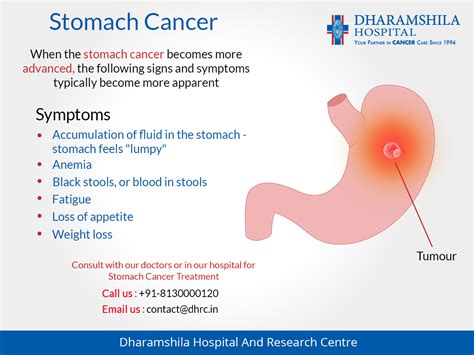 Early Warning Signs Stomach Cancer