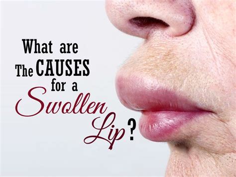 Swollen lips may have different causes, from mild conditions to more serious disorders ...