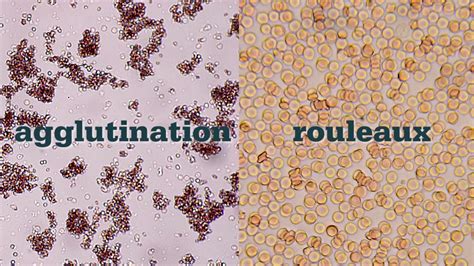 How to Perform a Saline Agglutination Test - YouTube