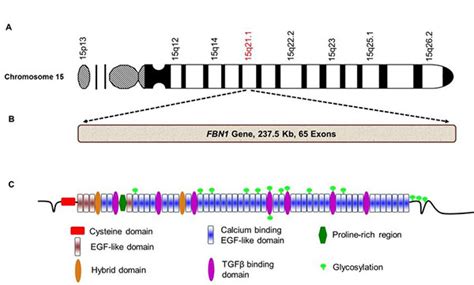 Marfan Syndrome - The Medical Biochemistry Page