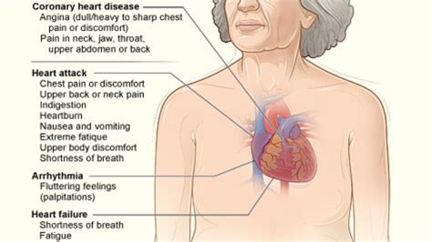 menopause and heart palpitations: heart palpitations symptoms/womens ...