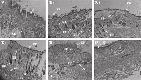 Histology of wounds by H&E staining in the diff erent groups on... | Download Scientific Diagram