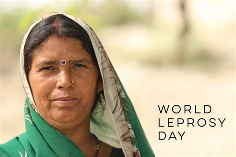 world-leprosy-day - Rising Star Outreach