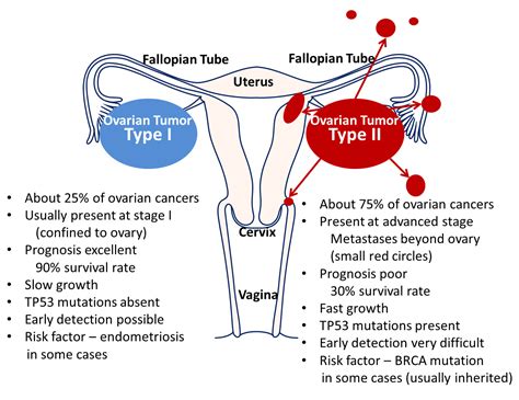 Ovarian cancer. Silent and deadly – Atlas of Science