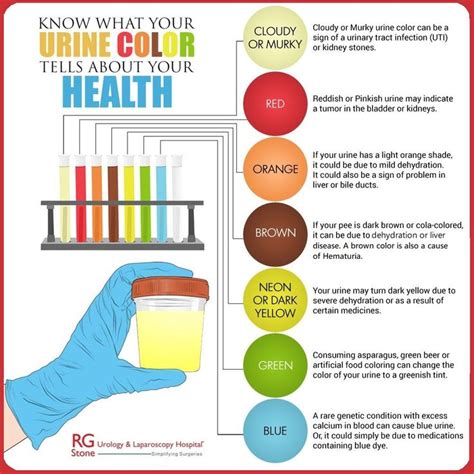 What Colour Is Your Pee? | Color of urine, Color, Health chart