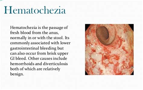 Hematochezia(혈변)과 Melena(흑변)의 차이점에 대해서. : 네이버 블로그