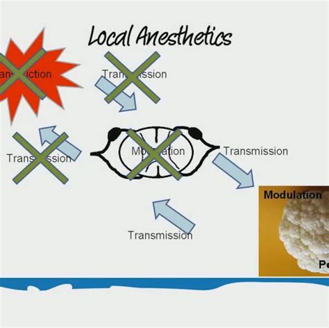 Multimodal Pain Management | atdove.org