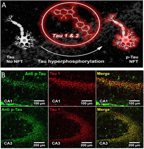 Frontiers | Molecular Imaging of Tau Protein: New Insights and Future Directions