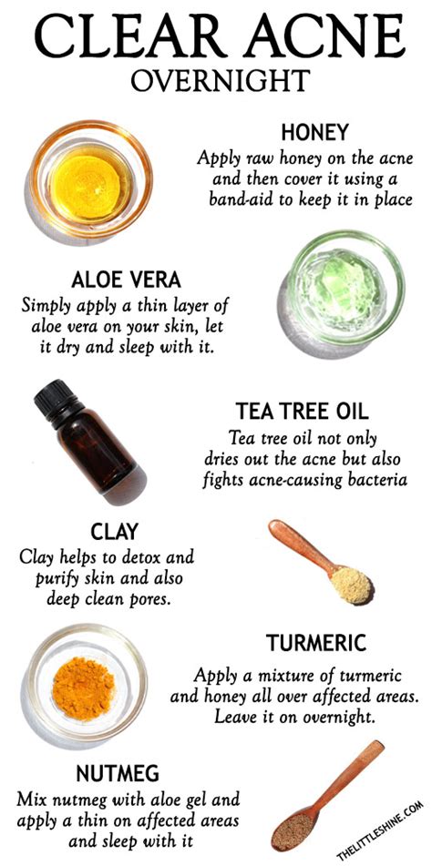 NATURAL REMEDIES TO CLEAR ACNE OVERNIGHT | The Little Shine