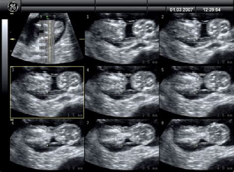 Figure 1 from Pregnancy monitoring in dogs and cats using 3D and 4D ultrasonography. | Semantic ...