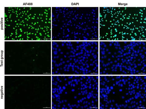 TUNEL Apoptosis Assay Kit (HRP-DAB) - Assay Genie