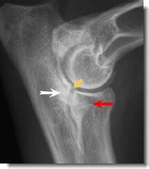 Elbow Dysplasia In Dogs: Symptoms And Treatment