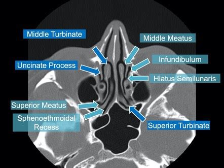 Playlist 'Annotated Anatomy' by Marc Hidalgo